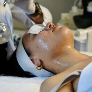 CHEMICAL PEEL