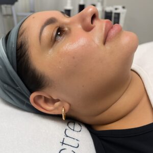 DERMA PLANE FACIAL