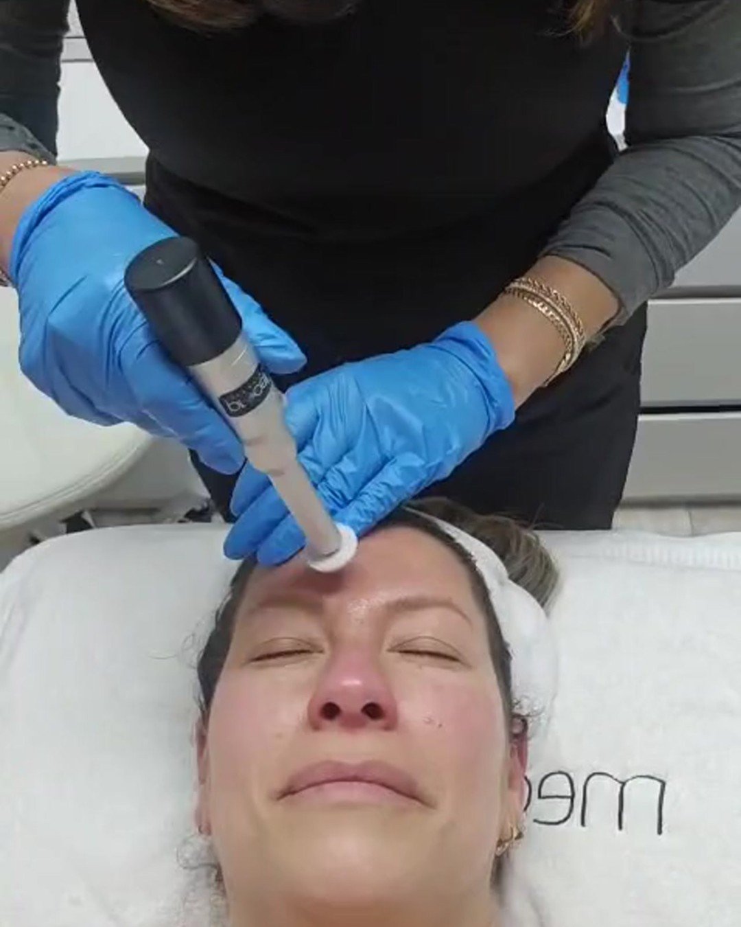 Norma Portela performing Procell Microchanneling at NP Skin Care